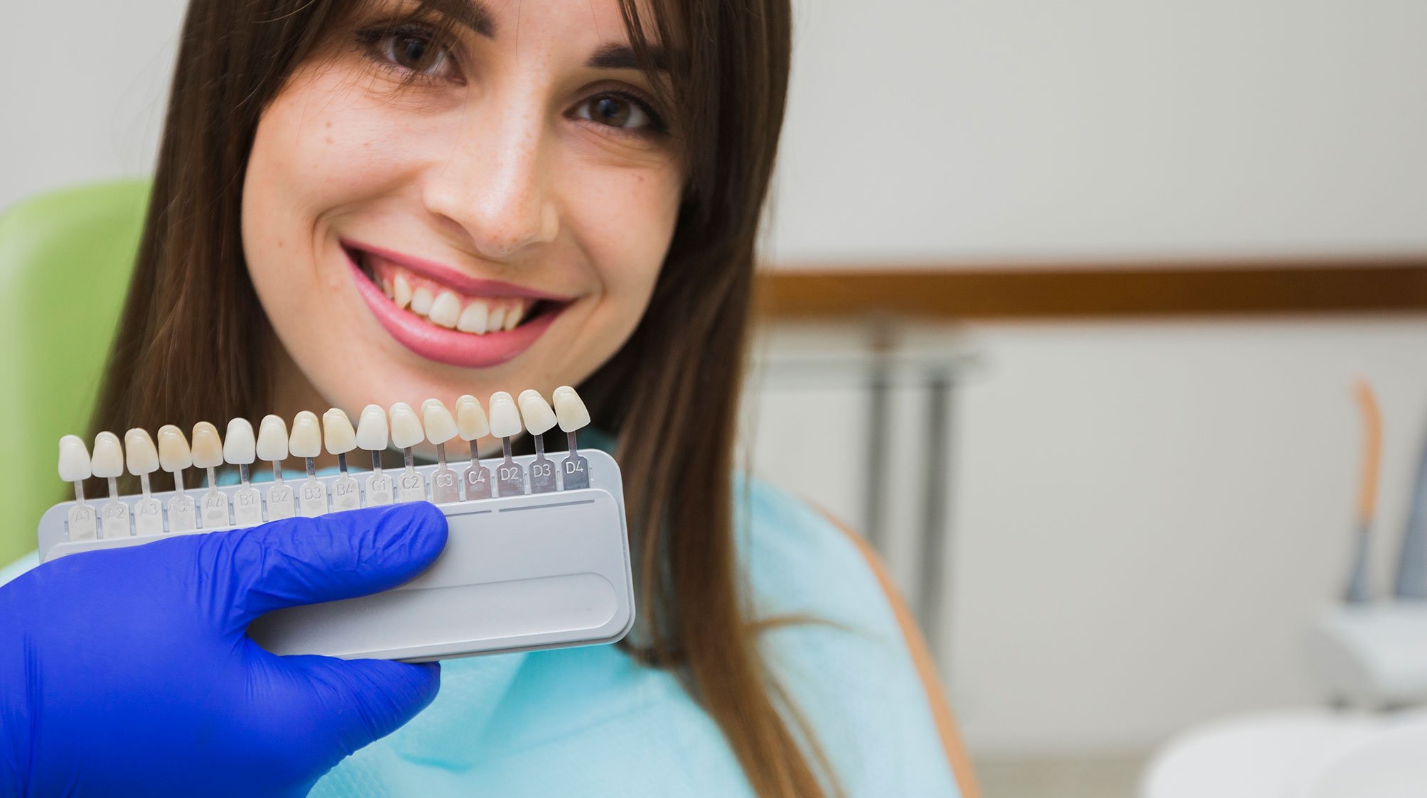 Carillas dentales, mejora tu sonrisa en Unclinic La Línea