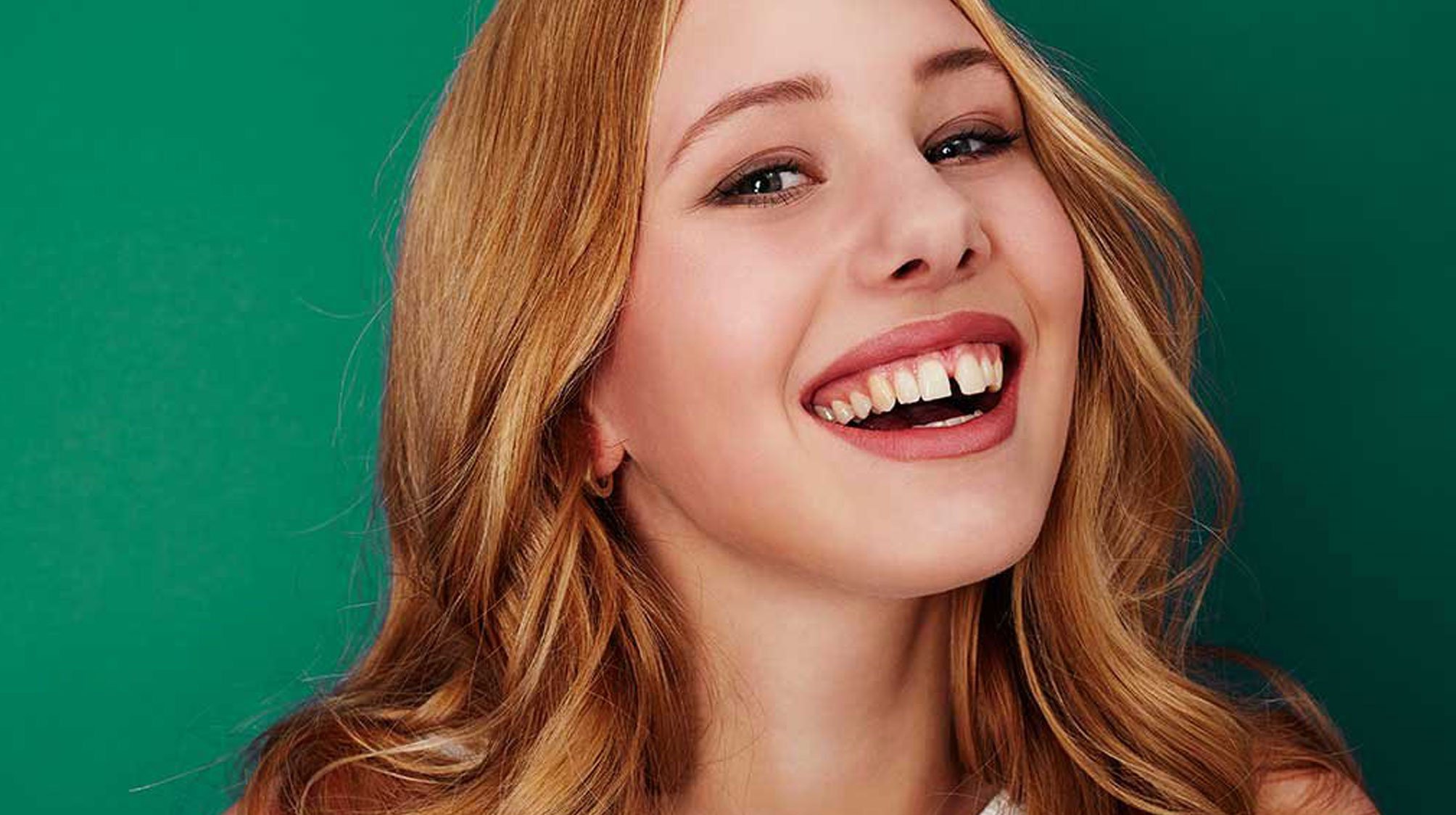 Solución a la diastema en Algeciras